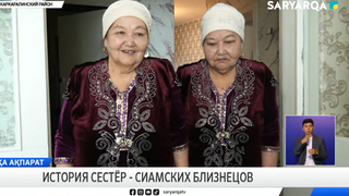 История сестёр - сиамских близнецов